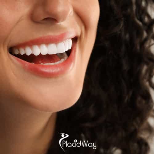 E-max vs Zirconium Veneers in Turkey: 7 Facts UK Cosmetic Patients Need to Decide